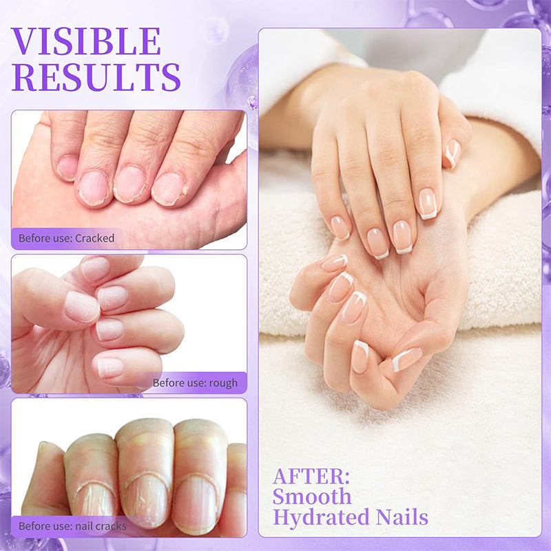 NailSoothe – Pflegender Nagelhautöl-Stift