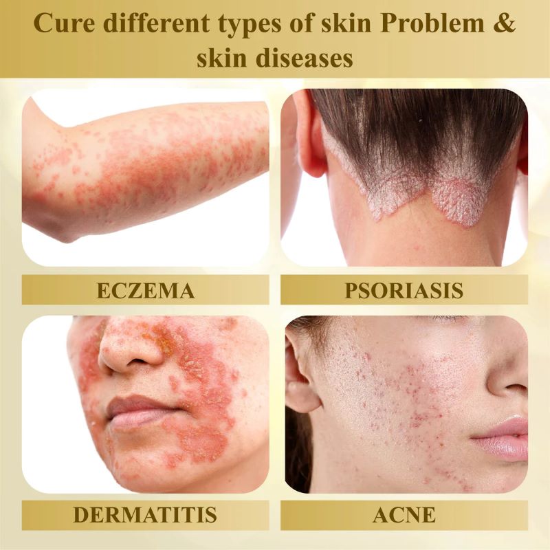 DermaVenom – Fortschrittliche Hautpflegecreme