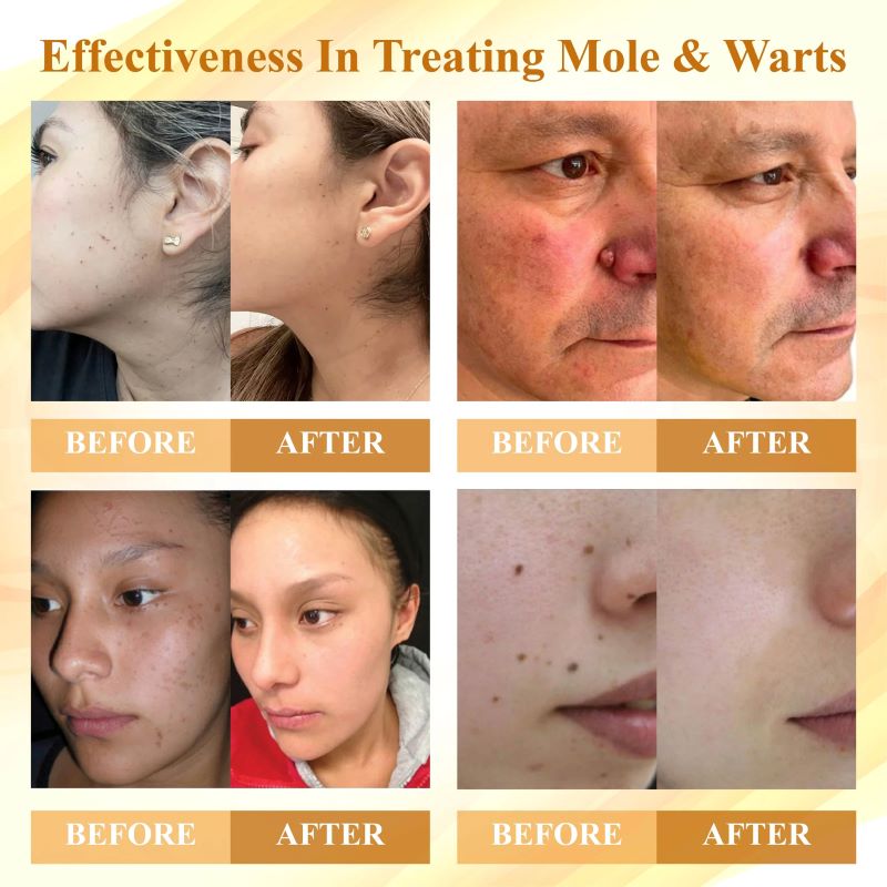 DermaVenom – Fortschrittliche Hautpflegecreme