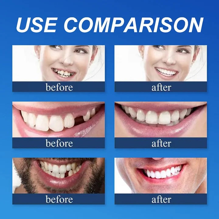 🌎Nur noch heute: 70 % Rabatt! ⏰Yagoo™ Medizinische Vollprothese mit starker Saugkraft🦷Erhalten Sie die Zertifizierung der American Dental Association (ADA).