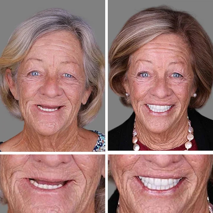 🌎Nur noch heute: 70 % Rabatt! ⏰Yagoo™ Medizinische Vollprothese mit starker Saugkraft🦷Erhalten Sie die Zertifizierung der American Dental Association (ADA).