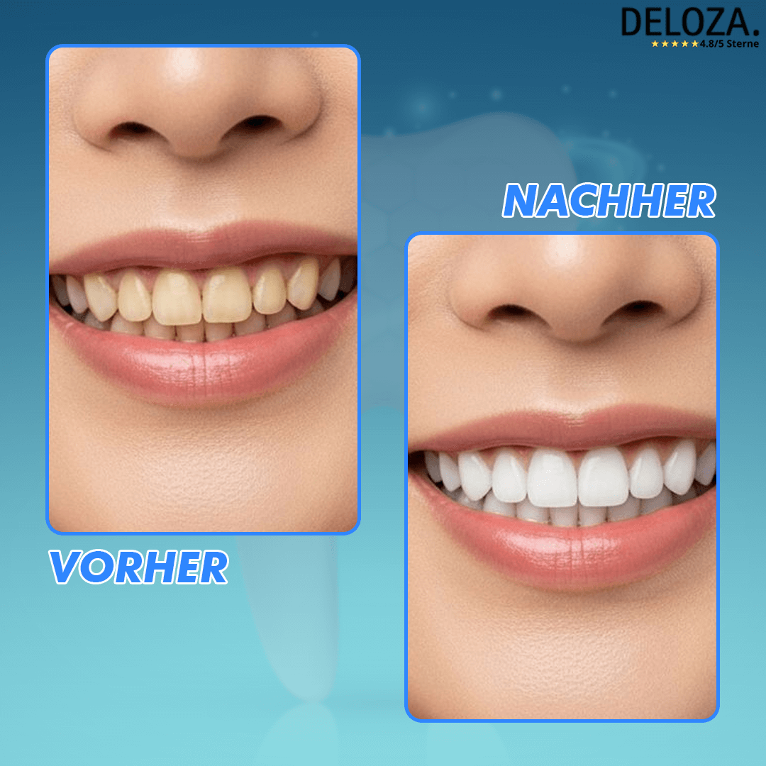 Brighten – Weißere Zähne in Sekunden [1+1 Gratis]