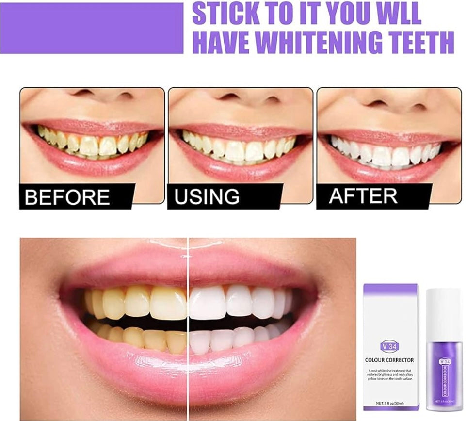 1+1 GRATIS | PureSmile® | Whitening Zahnpasta – Neutralisiert Gelbstich & sorgt für strahlende Zähne 😁