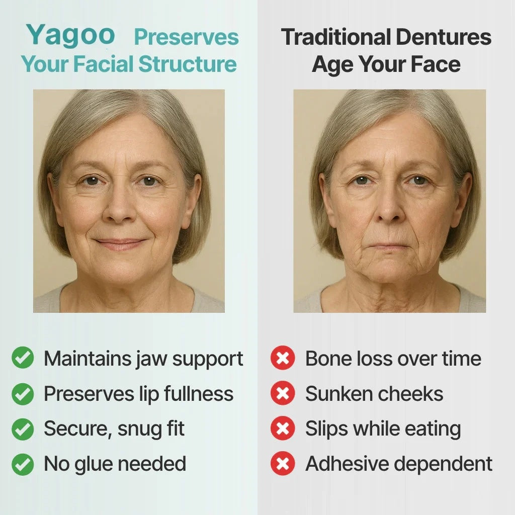 🌎Nur noch heute: 70 % Rabatt! ⏰Yagoo™ Medizinische Vollprothese mit starker Saugkraft🦷Erhalten Sie die Zertifizierung der American Dental Association (ADA).