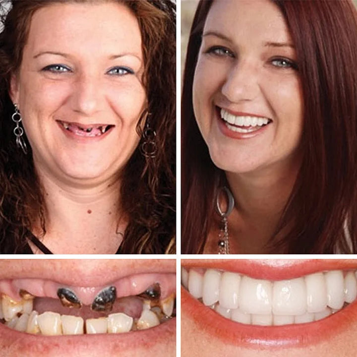 🌎Nur noch heute: 70 % Rabatt! ⏰Yagoo™ Medizinische Vollprothese mit starker Saugkraft🦷Erhalten Sie die Zertifizierung der American Dental Association (ADA).