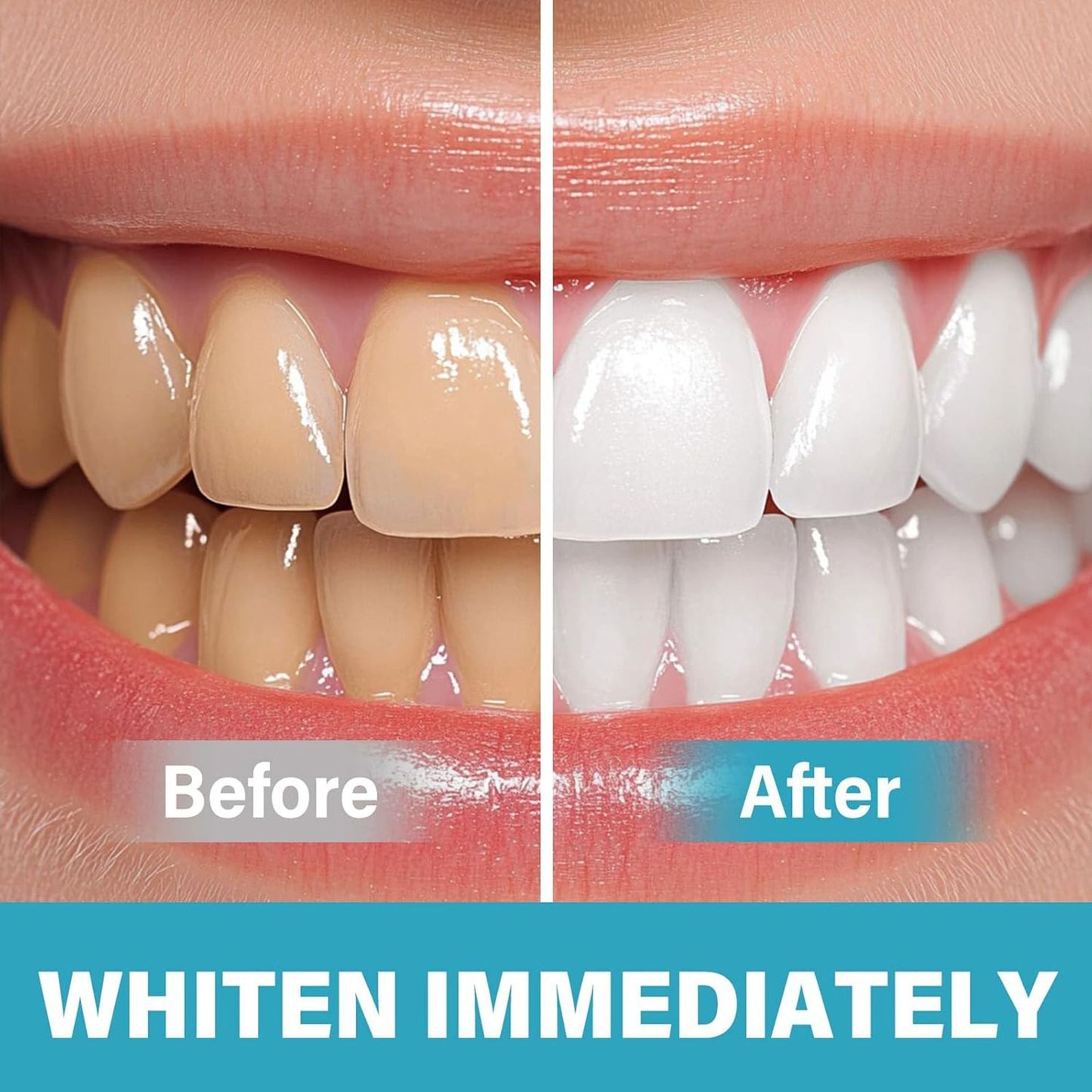 BrightSmile – Sofortige Zahnaufhellung mit Pigment