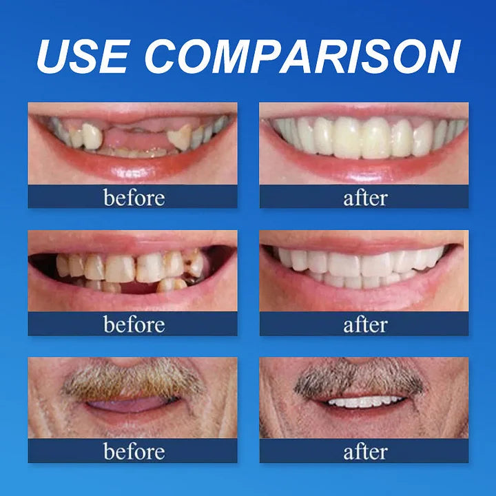 🌎Nur noch heute: 70 % Rabatt! ⏰Yagoo™ Medizinische Vollprothese mit starker Saugkraft🦷Erhalten Sie die Zertifizierung der American Dental Association (ADA).